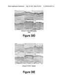 Molecular and Herbal Combinations for Treating Psoriasis diagram and image