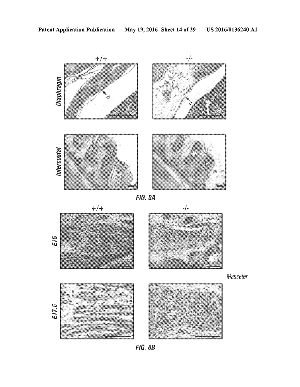 COMPOSITIONS AND METHODS RELATING TO MYOMAKER-INDUCED MUSCLE CELL FUSION - diagram, schematic, and image 15