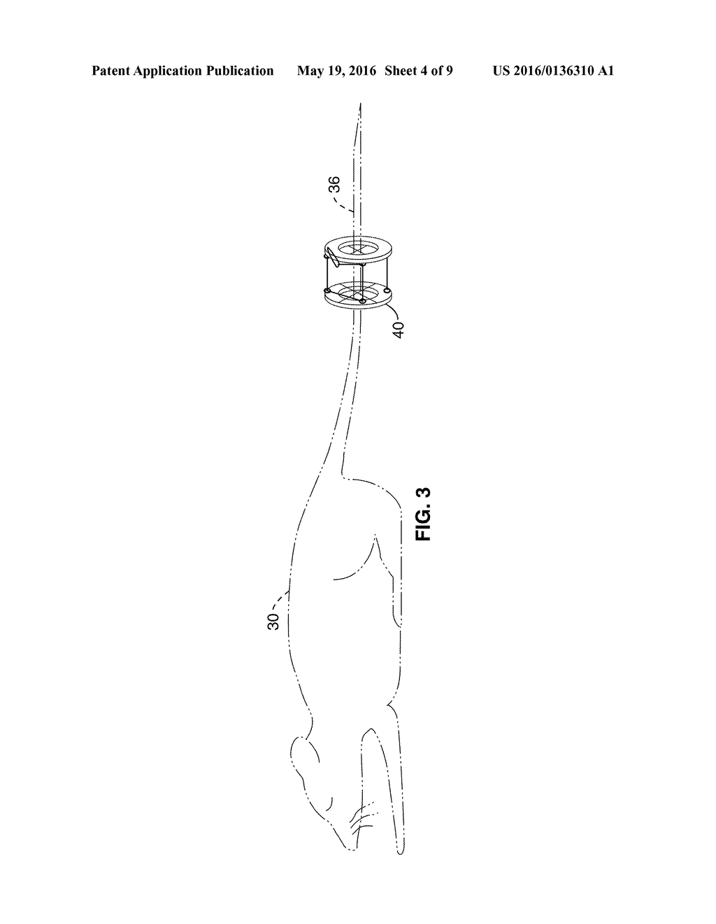 SYSTEMS, COMPOSITIONS, AND METHODS FOR LOCAL IMAGING AND TREATMENT OF PAIN - diagram, schematic, and image 05