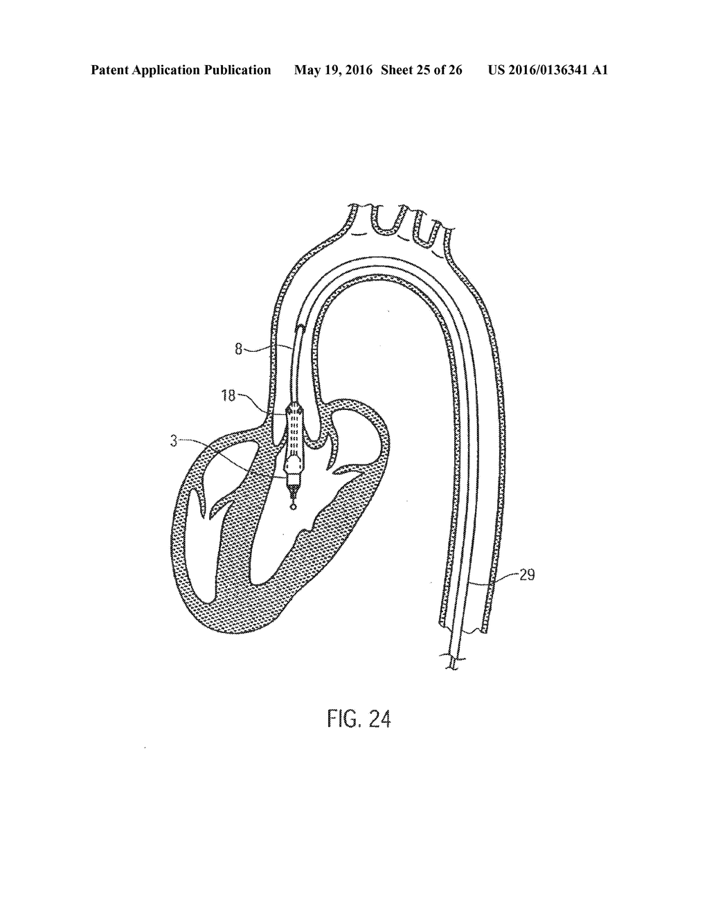 CATHETER DEVICE - diagram, schematic, and image 26