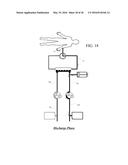 HEMODIALYSIS APPARATUS diagram and image