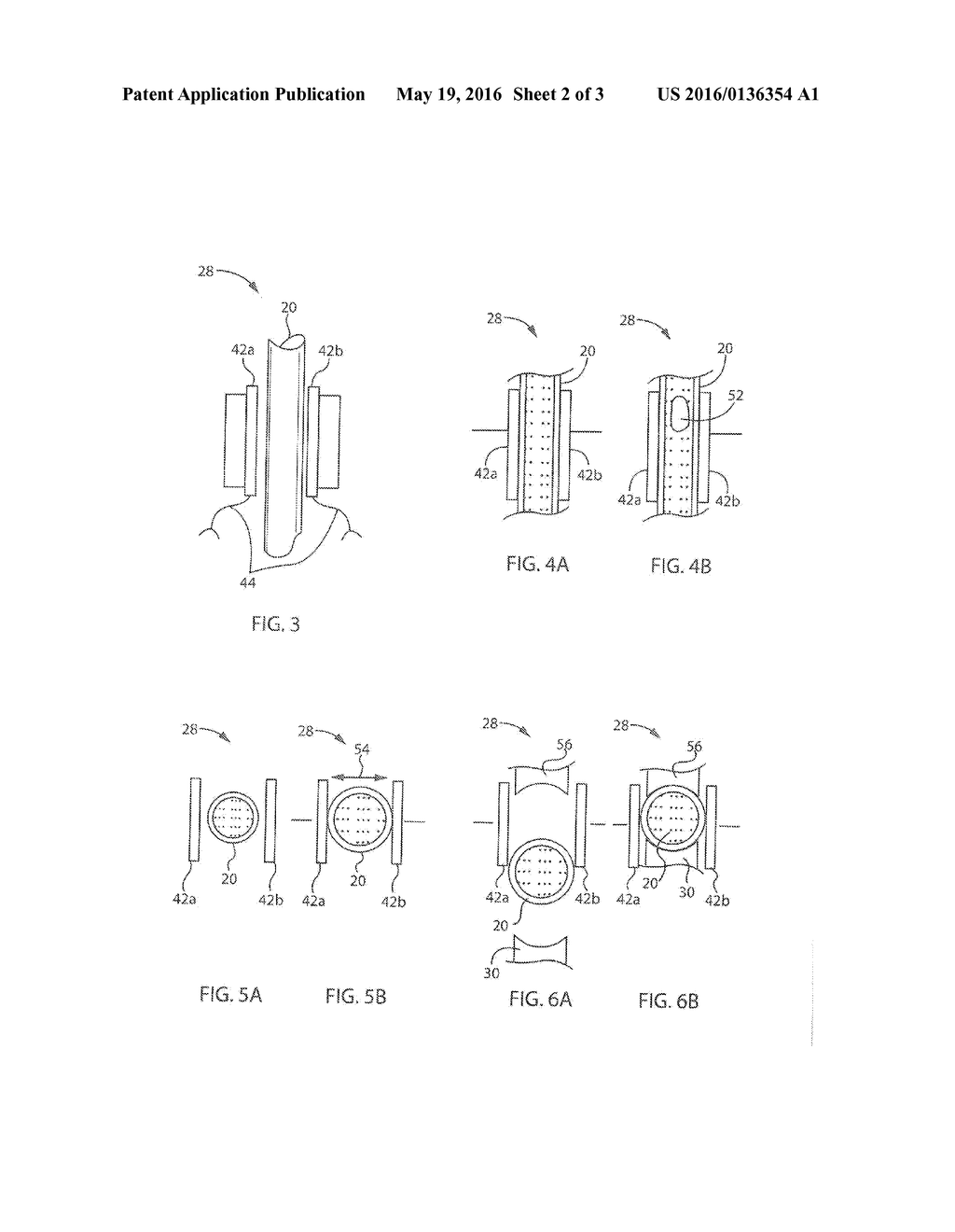 Multifunction Capacitive Sensor for Medical Pump - diagram, schematic, and image 03