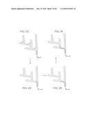 ADJUSTABLE STIFFNESS CATHETER diagram and image