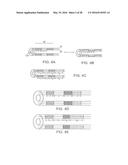 ADJUSTABLE STIFFNESS CATHETER diagram and image