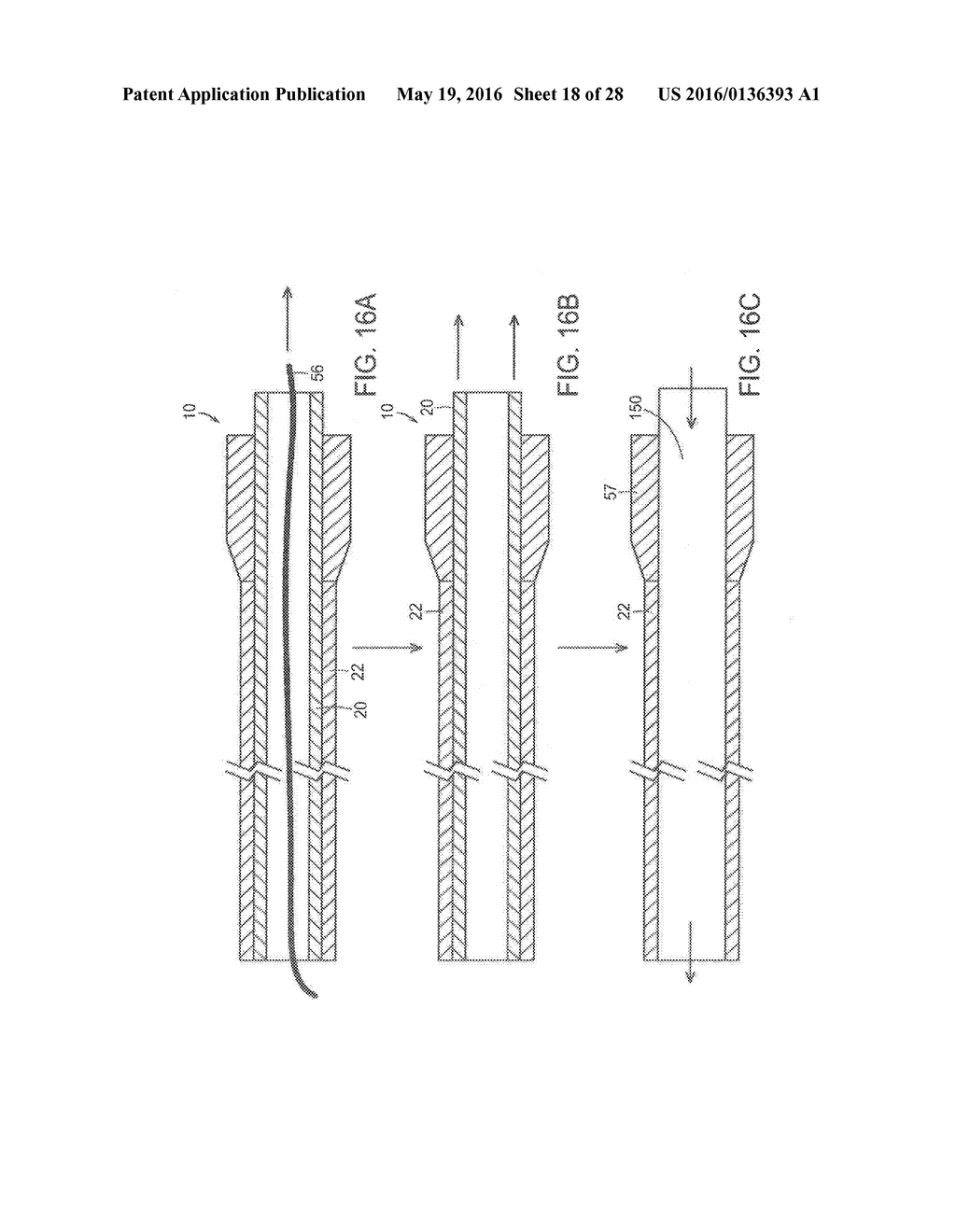 ADJUSTABLE STIFFNESS CATHETER - diagram, schematic, and image 19