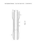 ADJUSTABLE STIFFNESS CATHETER diagram and image