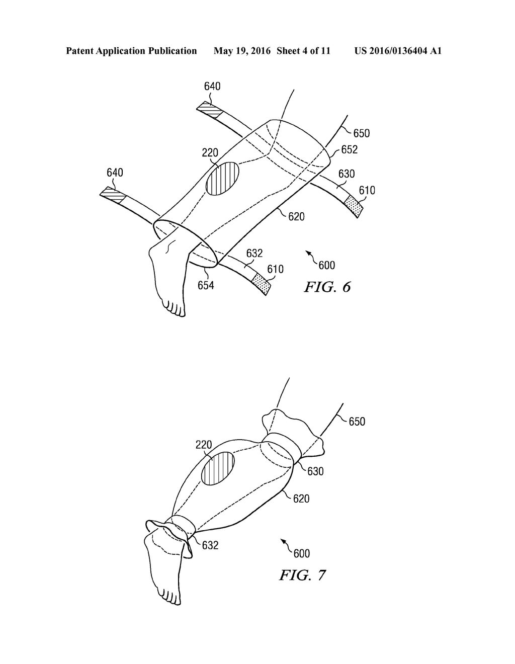 APPARATUS AND METHOD FOR DEPLOYING A SURGICAL PREPARATION - diagram, schematic, and image 05