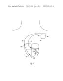 PACING AND SENSING VECTORS diagram and image