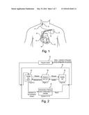 ACTIVE IMPLANTABLE MEDICAL DEVICE WITH CARDIAC LEAD AND PERIPHERAL LEAD     DISCRIMINATION diagram and image