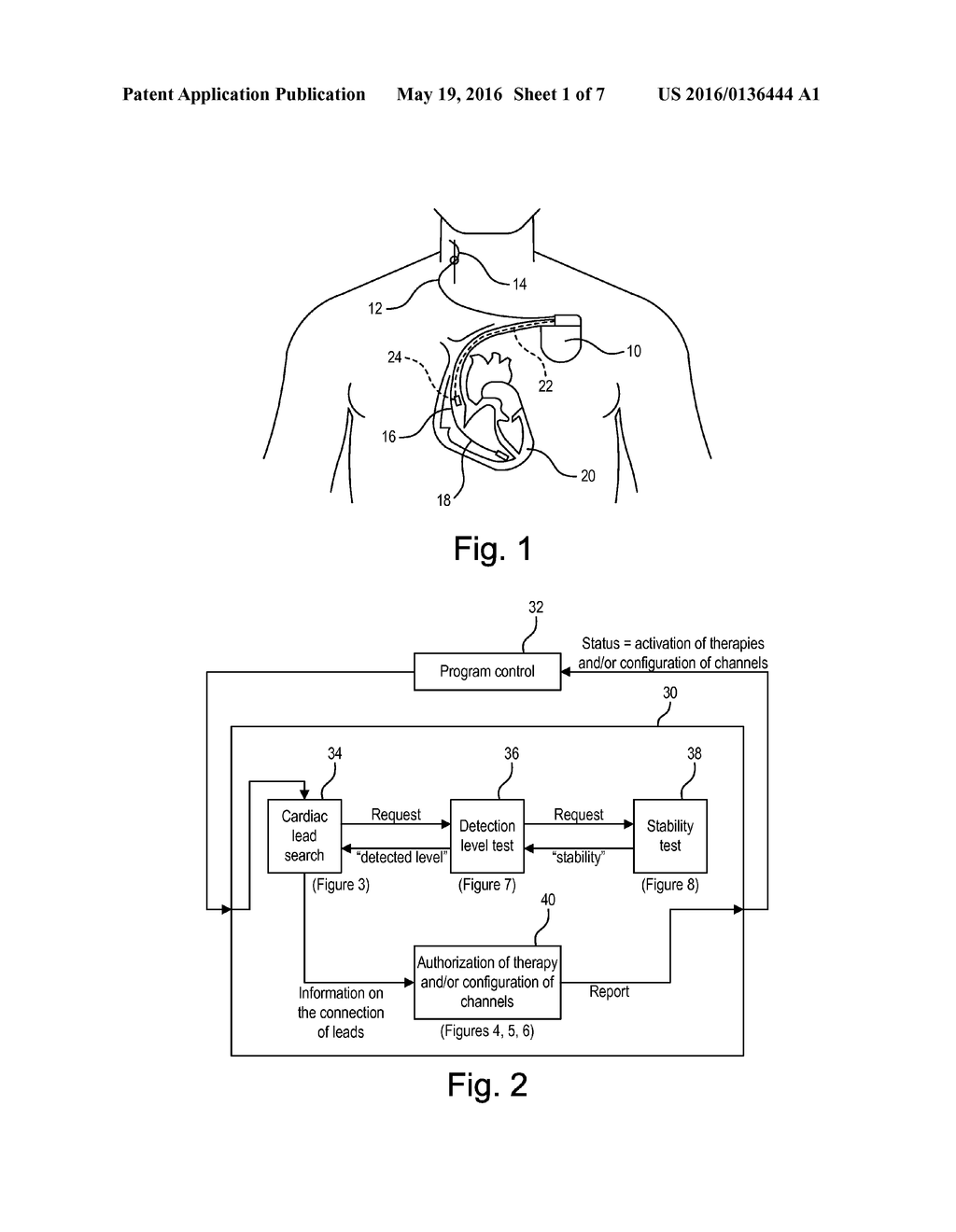 ACTIVE IMPLANTABLE MEDICAL DEVICE WITH CARDIAC LEAD AND PERIPHERAL LEAD     DISCRIMINATION - diagram, schematic, and image 02