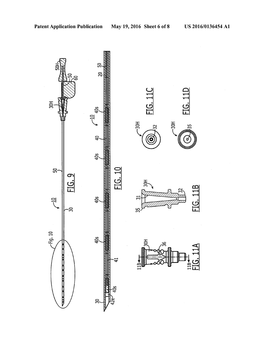 TETHERED AND/OR VISUALLY CODED BRACHYTHERAPY DEVICES AND RELATED METHODS - diagram, schematic, and image 07