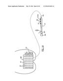 TETHERED AND/OR VISUALLY CODED BRACHYTHERAPY DEVICES AND RELATED METHODS diagram and image