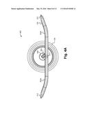 PITCH-PROPELLED VEHICLE diagram and image