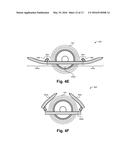 PITCH-PROPELLED VEHICLE diagram and image