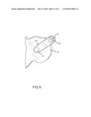 Rotational Wedge Locking Mechanism for a Folding Knife diagram and image