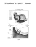 Techniques for Automatically Placing Escape Holes during Three-Dimensional     Printing diagram and image