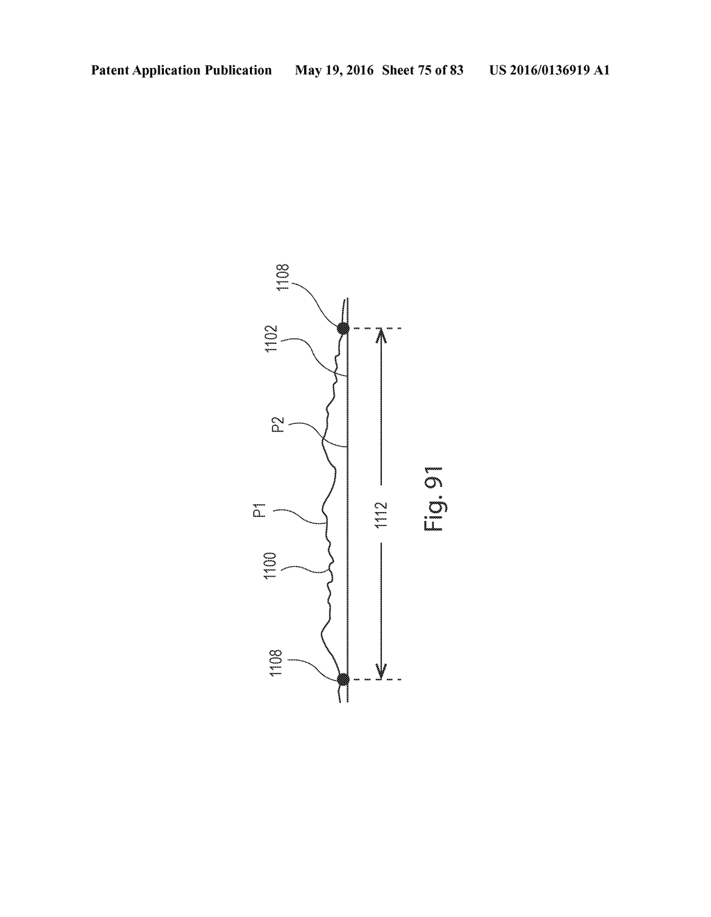 ZONAL PATTERNED APERTURED WEBS, LAMINATES, AND METHODS FOR MAKING THE SAME - diagram, schematic, and image 76