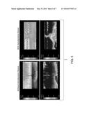 AERODYNAMIC DEVICE TO OPTIMIZE AIR FLOW THROUGH HEAT EXCHANGERS diagram and image