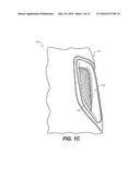 EXTERNAL ATTACHMENTS FOR SPEAKERS IN SEATS diagram and image