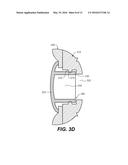 EXTERNAL ATTACHMENTS FOR SPEAKERS IN SEATS diagram and image