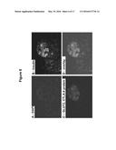 ANTI-CTLA4, ANTI-GLUT2 PROTEIN FOR THE TREATMENT OF TYPE 1 DIABETES diagram and image