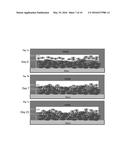 EX VIVO HUMAN MULTIPLE MYELOMA CANCER NICHE AND ITS USE AS A MODEL FOR     PERSONALIZED TREATMENT OF MULTIPLE MYELOMA diagram and image