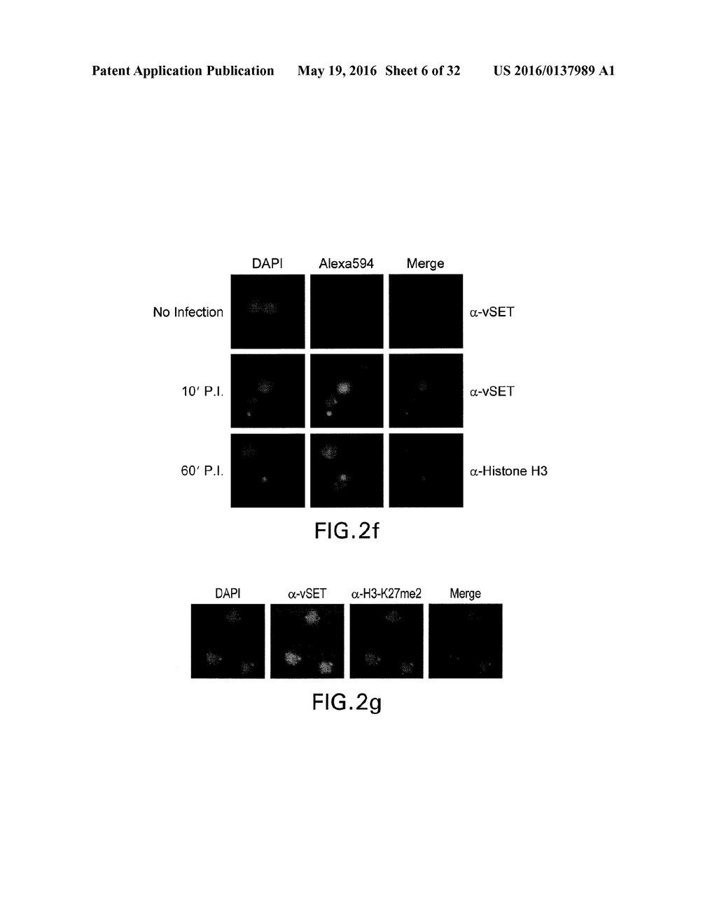 METHOD OF SUPPRESSING GENE TRANSCRIPTION THROUGH HISTONE LYSINE     METHYLATION - diagram, schematic, and image 07