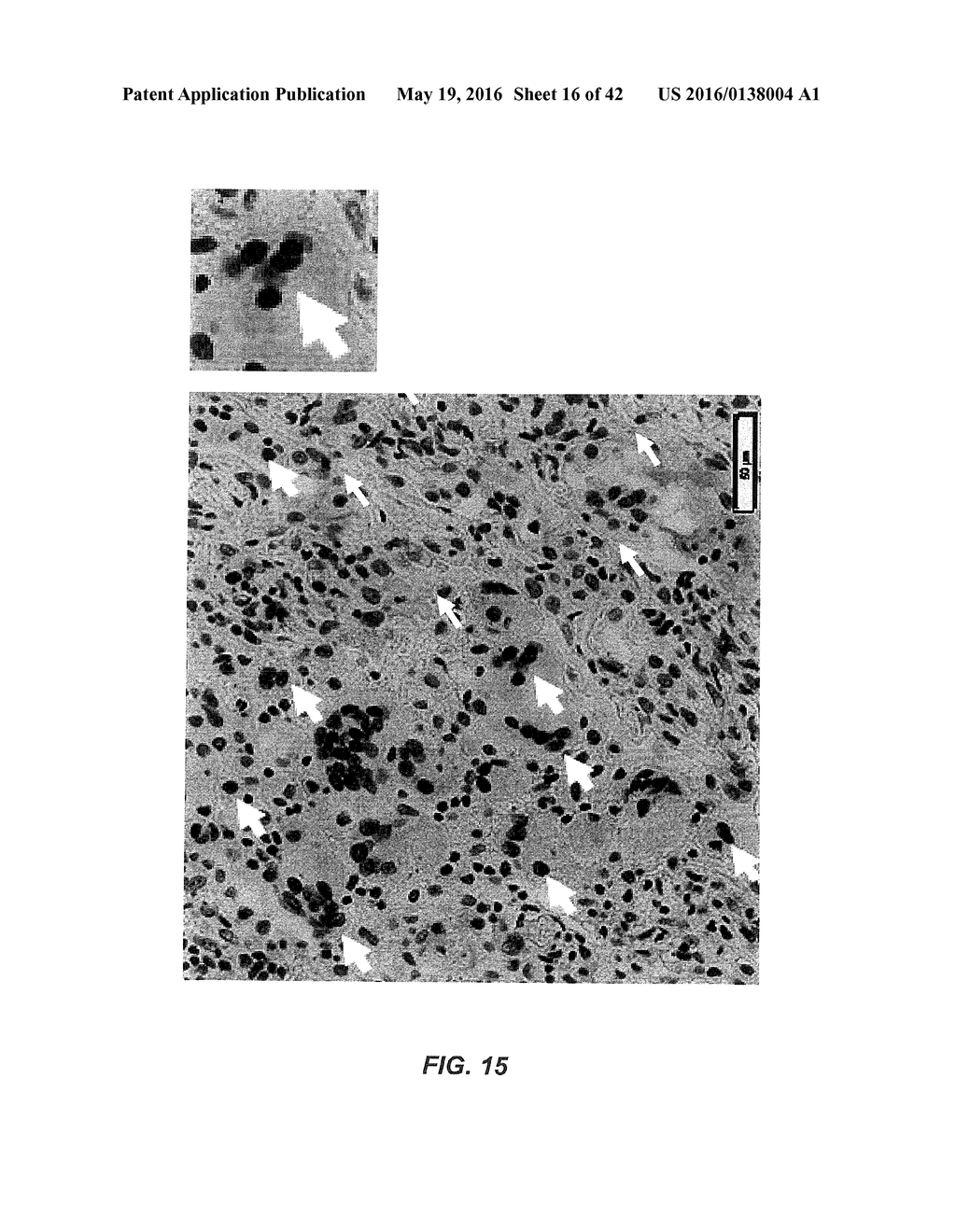 Amino Acid Sequence Presenting Fusion Polypeptide And Its Use - diagram, schematic, and image 17