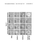 ANTISENSE OLIGONUCLTEOTIDES FOR TREATMENT OF CANCER STEM CELLS diagram and image