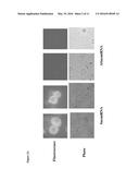 METHODS FOR DETECTING AND TREATING MULTIPLE MYELOMA diagram and image