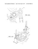 SYSTEMS, METHODS, AND DEVICES FOR VALVE STEM POSITION SENSING diagram and image