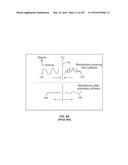 SYSTEMS AND METHODS FOR COLLISION COMPUTING FOR DETECTION AND NONINVASIVE     MEASUREMENT OF BLOOD GLUCOSE AND OTHER SUBSTANCES AND EVENTS diagram and image