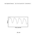 SYSTEMS AND METHODS FOR COLLISION COMPUTING FOR DETECTION AND NONINVASIVE     MEASUREMENT OF BLOOD GLUCOSE AND OTHER SUBSTANCES AND EVENTS diagram and image