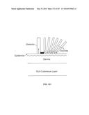 SYSTEMS AND METHODS FOR SYNTHESIS OF ZYOTONS FOR USE IN COLLISION     COMPUTING FOR NONINVASIVE BLOOD GLUCOSE AND OTHER MEASUREMENTS diagram and image