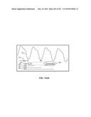 SYSTEMS AND METHODS FOR SYNTHESIS OF ZYOTONS FOR USE IN COLLISION     COMPUTING FOR NONINVASIVE BLOOD GLUCOSE AND OTHER MEASUREMENTS diagram and image