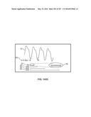 SYSTEMS AND METHODS FOR SYNTHESIS OF ZYOTONS FOR USE IN COLLISION     COMPUTING FOR NONINVASIVE BLOOD GLUCOSE AND OTHER MEASUREMENTS diagram and image