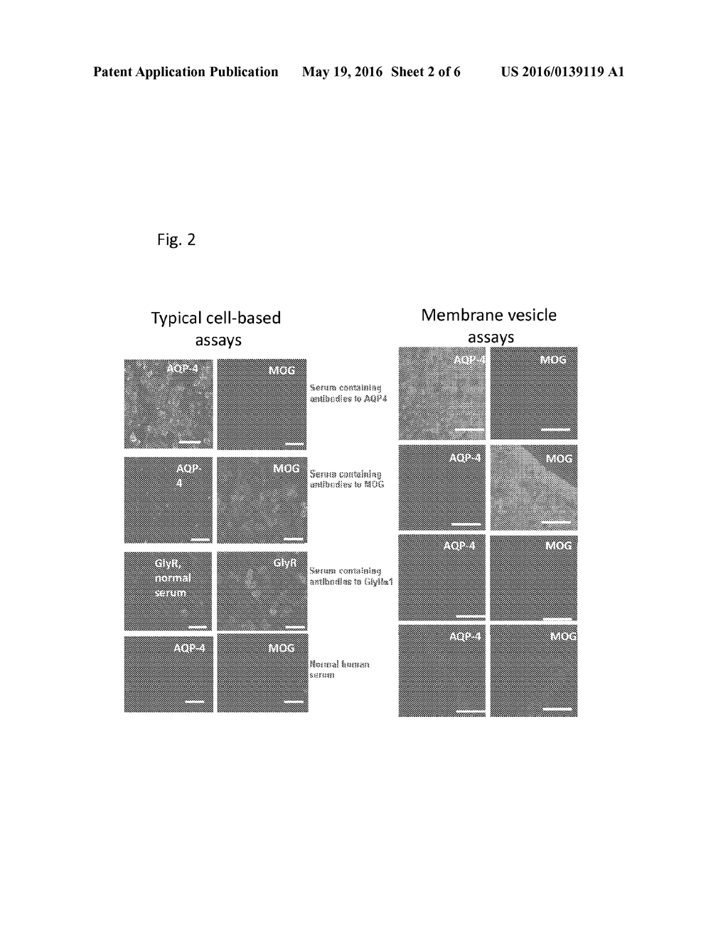 METHOD OF DETECTING THE PRESENCE OR ABSENCE OF AUTOANTIBODIES - diagram, schematic, and image 03