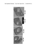 DETECTING TARGETS USING MASS TAGS AND MASS SPECTROMETRY diagram and image