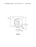 Screen vibration for reducing speckle diagram and image