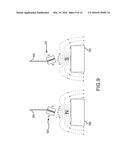 Screen vibration for reducing speckle diagram and image