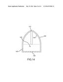 Screen vibration for reducing speckle diagram and image