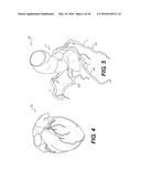 METHOD AND SYSTEM FOR IMAGE PROCESSING TO DETERMINE PATIENT-SPECIFIC BLOOD     FLOW CHARACTERISTICS diagram and image