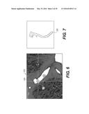 METHOD AND SYSTEM FOR IMAGE PROCESSING TO DETERMINE PATIENT-SPECIFIC BLOOD     FLOW CHARACTERISTICS diagram and image