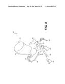 METHOD AND SYSTEM FOR IMAGE PROCESSING TO DETERMINE PATIENT-SPECIFIC BLOOD     FLOW CHARACTERISTICS diagram and image