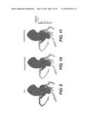 METHOD AND SYSTEM FOR IMAGE PROCESSING TO DETERMINE PATIENT-SPECIFIC BLOOD     FLOW CHARACTERISTICS diagram and image