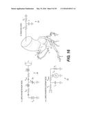 METHOD AND SYSTEM FOR IMAGE PROCESSING TO DETERMINE PATIENT-SPECIFIC BLOOD     FLOW CHARACTERISTICS diagram and image