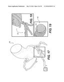 METHOD AND SYSTEM FOR IMAGE PROCESSING TO DETERMINE PATIENT-SPECIFIC BLOOD     FLOW CHARACTERISTICS diagram and image