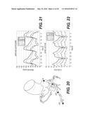 METHOD AND SYSTEM FOR IMAGE PROCESSING TO DETERMINE PATIENT-SPECIFIC BLOOD     FLOW CHARACTERISTICS diagram and image