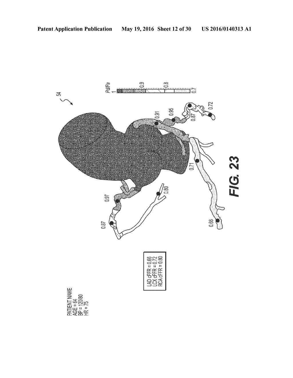 METHOD AND SYSTEM FOR IMAGE PROCESSING TO DETERMINE PATIENT-SPECIFIC BLOOD     FLOW CHARACTERISTICS - diagram, schematic, and image 13