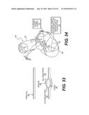 METHOD AND SYSTEM FOR IMAGE PROCESSING TO DETERMINE PATIENT-SPECIFIC BLOOD     FLOW CHARACTERISTICS diagram and image